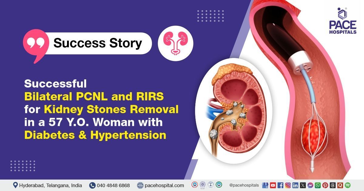 Successful Bilateral PCNL & RIRS done for Kidney Stones removal at PACE Hospitals, Hyderabad
