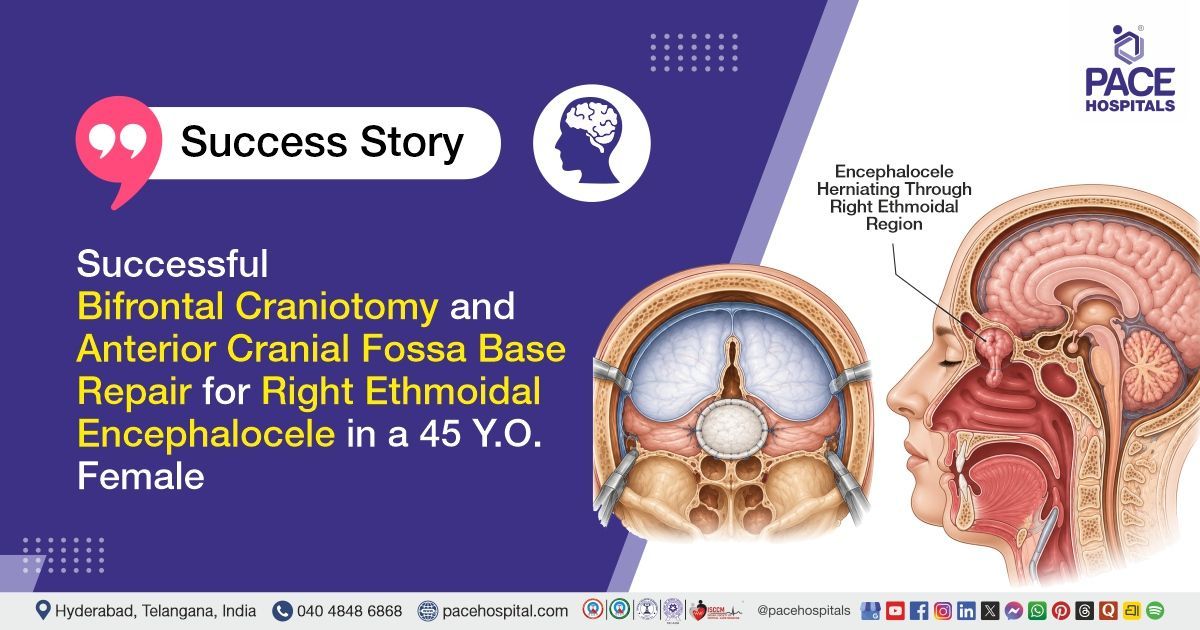 Successful craniotomy & anterior cranial fossa repair for ethmoidal encephalocele at PACE Hospitals