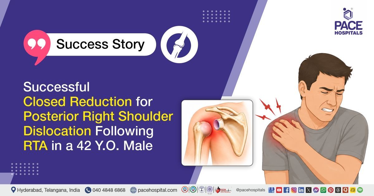 Successful Closed reduction for posterior right shoulder dislocation treatment at PACE Hospitals
