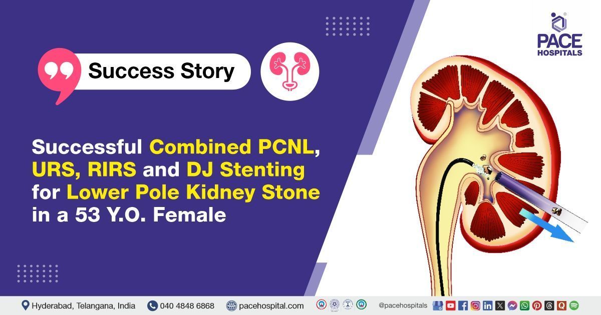 Successful PCNL, URS, RIRS & DJ stenting for lower pole kidney stone treatment done at PACE Hospital