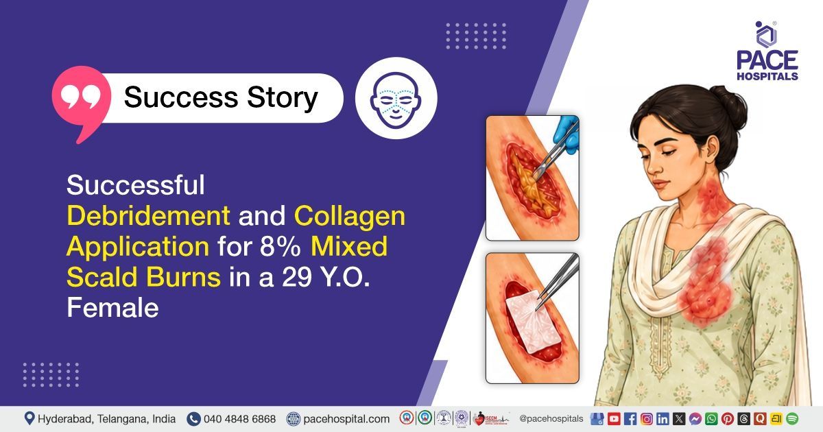 Successful Debridement and Collagen Application for Scald Burns Treatment at PACE Hospitals