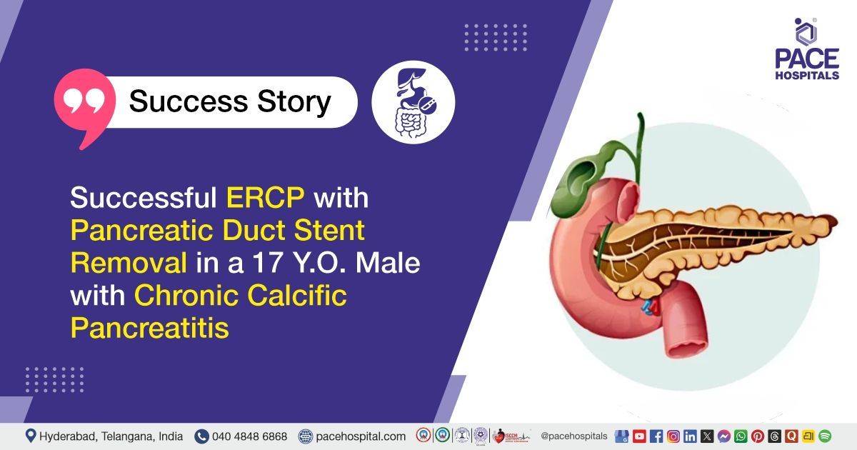 Case study of 17-YO patient who underwent ERCP treatment for chronic pancreatitis at PACE Hospitals