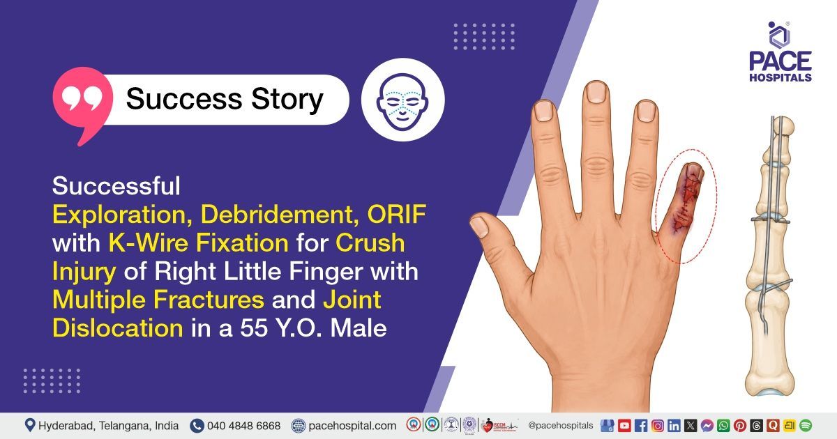 Successful ORIF with K-Wire Fixation for Right Little Finger Fractures Treatment at PACE Hospitals