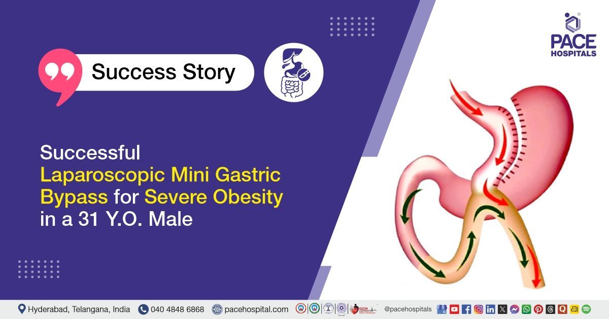 Successful Laparoscopic Mini Gastric Bypass for Severe Obesity at PACE Hospitals