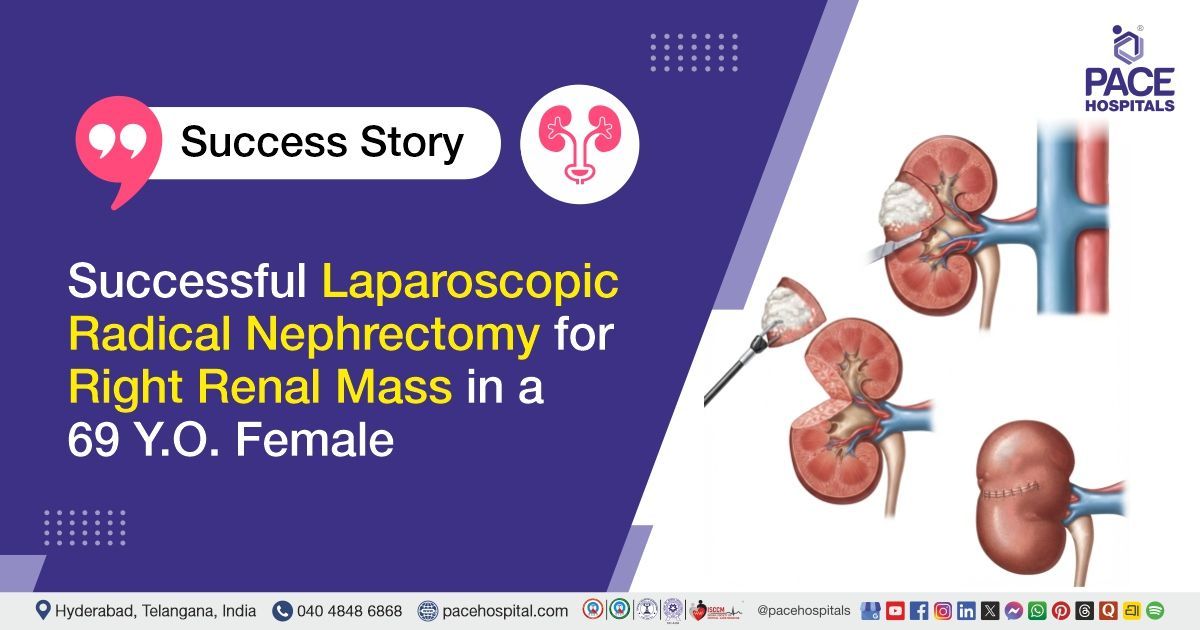 Successful Laparoscopic Radical Nephrectomy for Right Renal Mass Treatment at PACE Hospitals