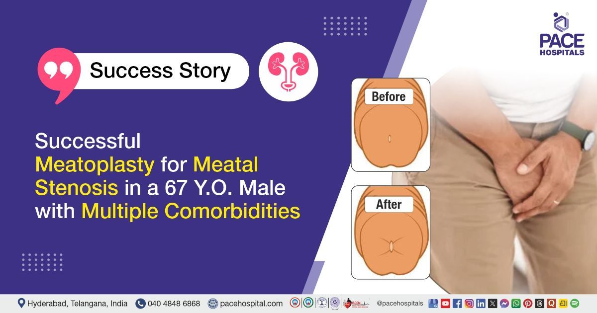 Successful Meatoplasty Surgery for Meatal Stenosis Treatment at PACE Hospitals