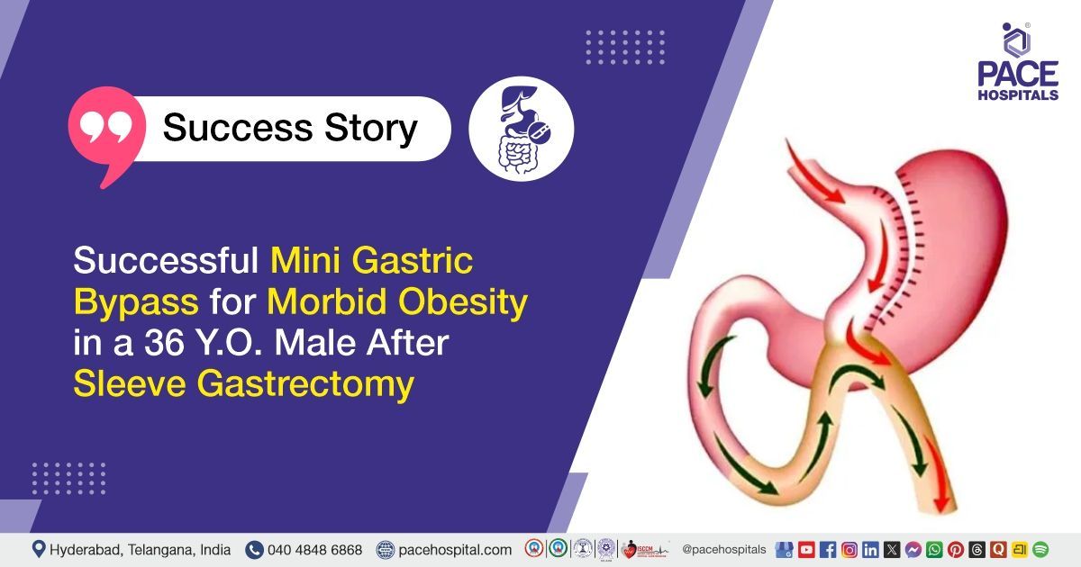 Case study of Morbid Obesity Treated with Mini Gastric Bypass Procedure at PACE Hospitals
