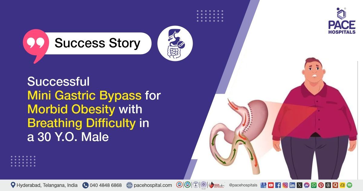 30-year-old male treated for morbid obesity with laparoscopic mini gastric bypass at PACE Hospitals.