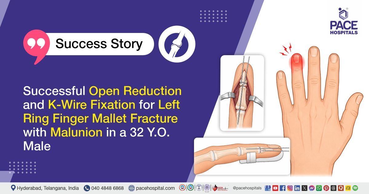 Successful Open reduction and K-wire fixation for left ring finger mallet fracture at PACE Hospitals