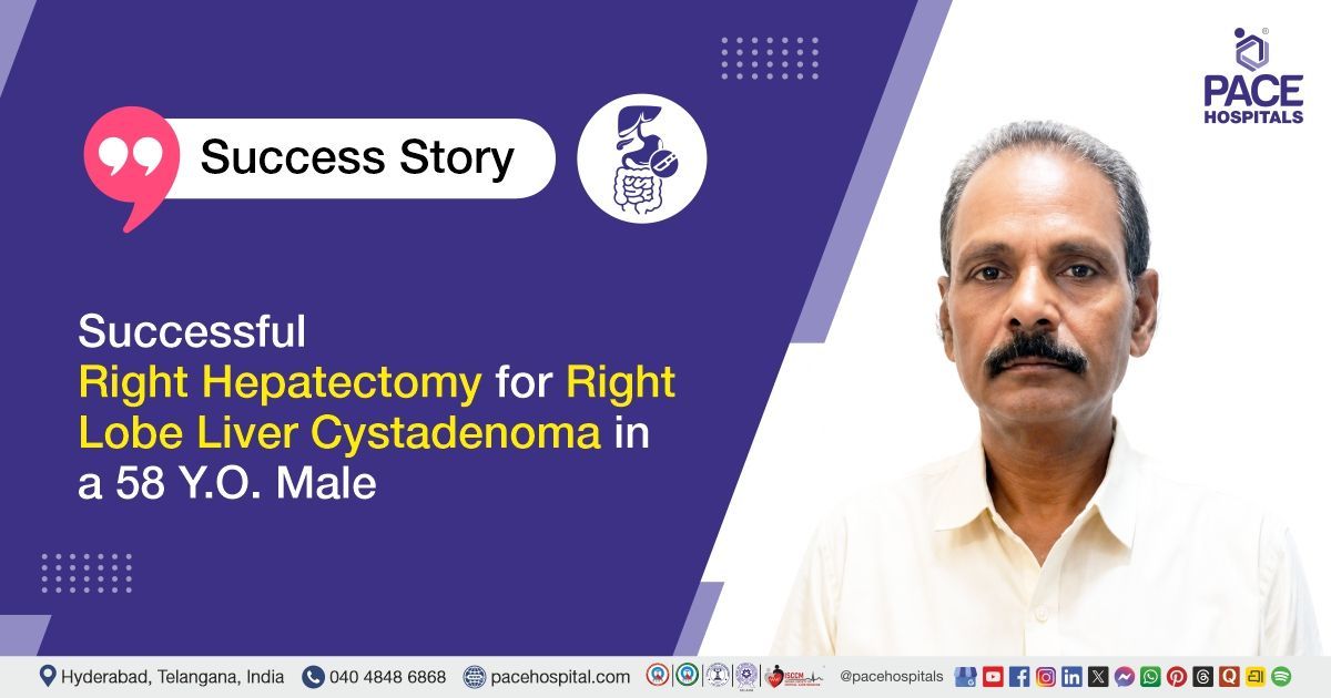 Case study of 58-YO male with painful biliary cystadenoma finds relief through right hepatectomy
