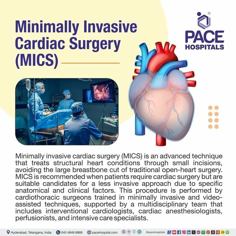 What is Minimally Invasive Cardiac Surgery? What is MICS Surgery? | MICS surgery meaning