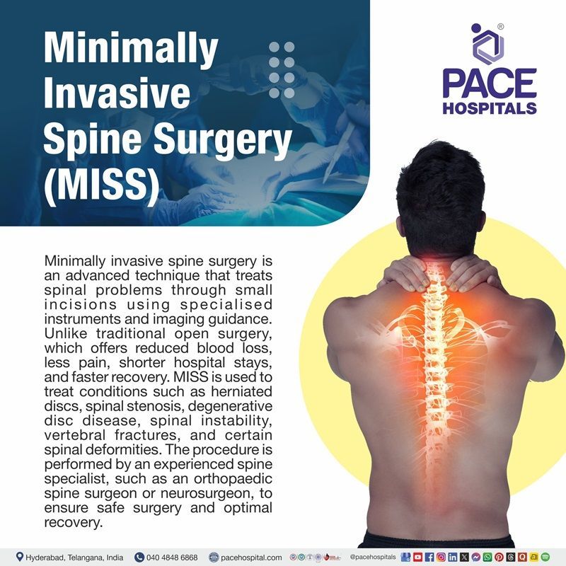 What is Minimally Invasive Spine Surgery (MISS)? What is minimally invasive spine surgery | minimally invasive spine surgery-MISS