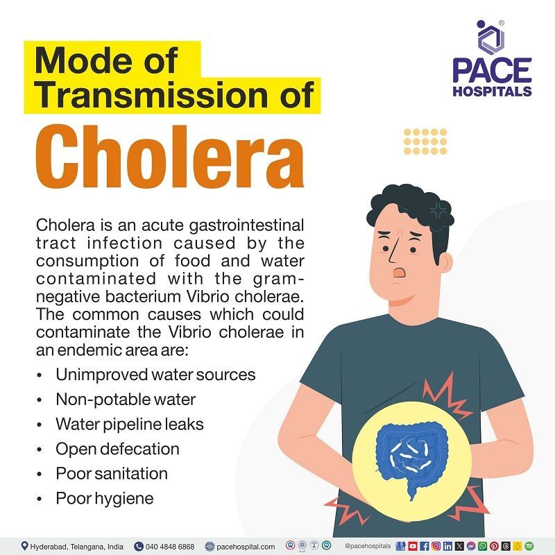 Different modes of Cholera transmission What is the mode of transmission of cholera | mode of infection of cholera | how | How cholera transmits | How cholera spreads | A visual depicting different modes of transmission of cholera disease and a person affected by the transmission of cholera.