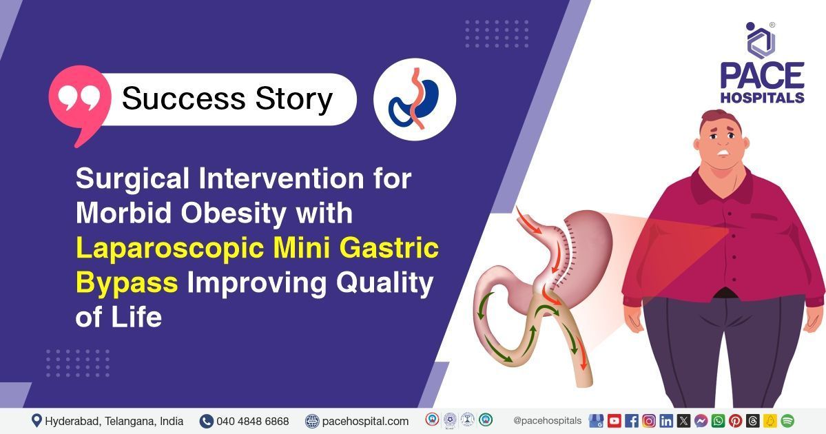 30-year-old male treated for morbid obesity with laparoscopic mini gastric bypass at PACE Hospitals.