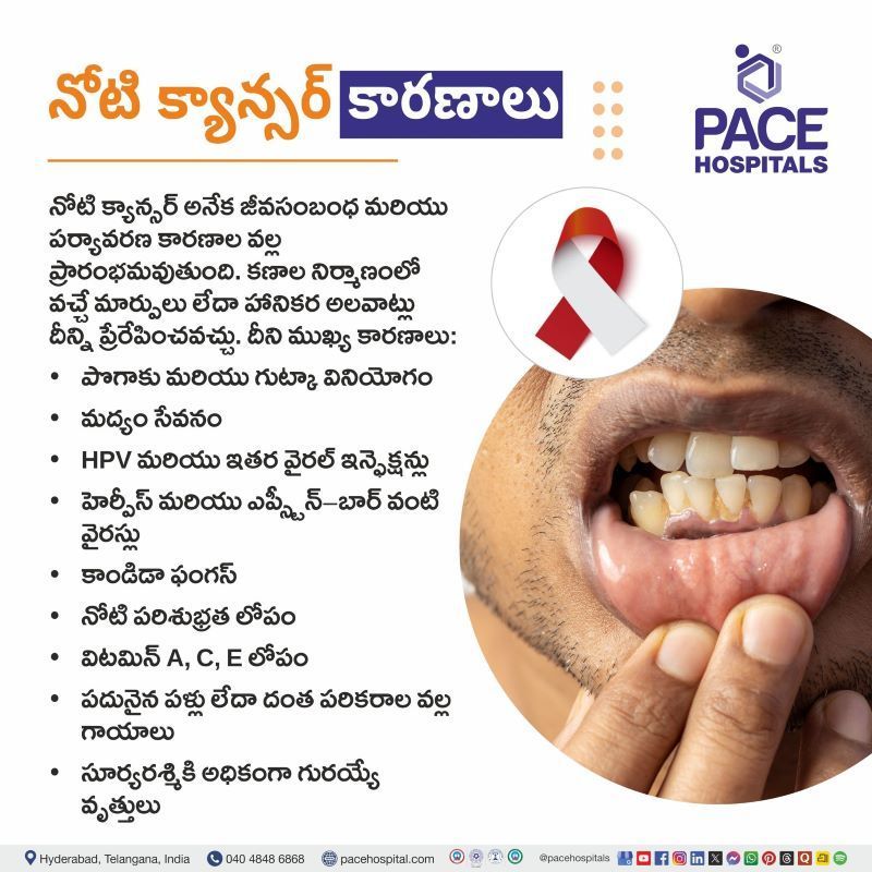 Mouth Cancer Causes in Telugu | నోటి క్యాన్సర్ కారణాలు | Oral Cancer Causes in Teugu