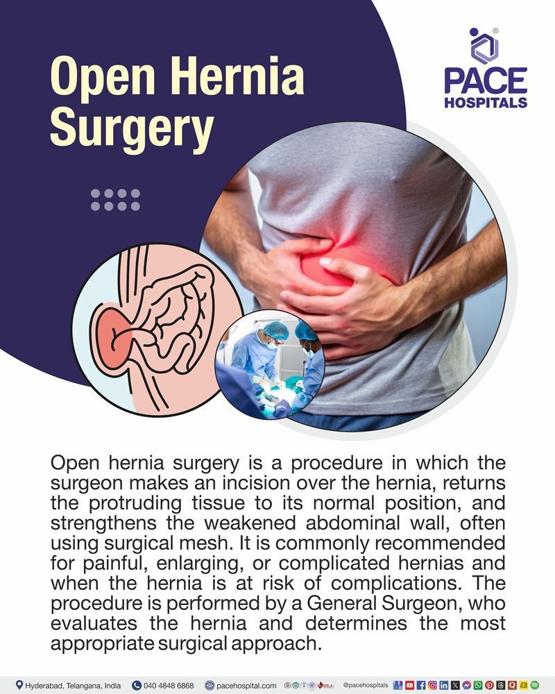 Open Hernia Surgery Meaning Visual guide to open hernia surgery, illustrating the procedure, hernia repair, and abdominal wall strengthening.