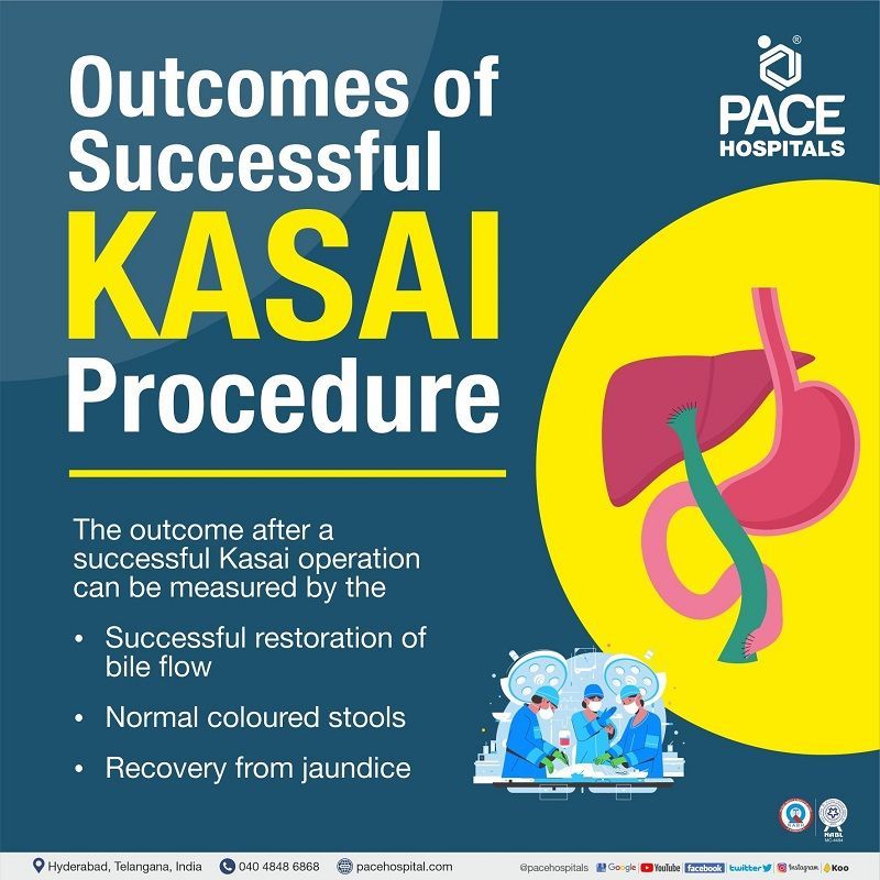 Outcome after successful the Kasai Procedure for biliary atresia treatment Outcome after successful the Kasai Procedure for biliary atresia treatment | Best Hospital in India for Kasai Procedure