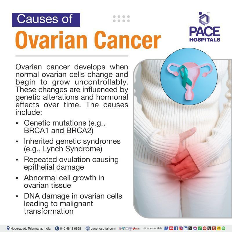Ovarian Cancer Causes Ovarian Cancer Causes | What causes ovarian cancer | Causes of ovarian cancer