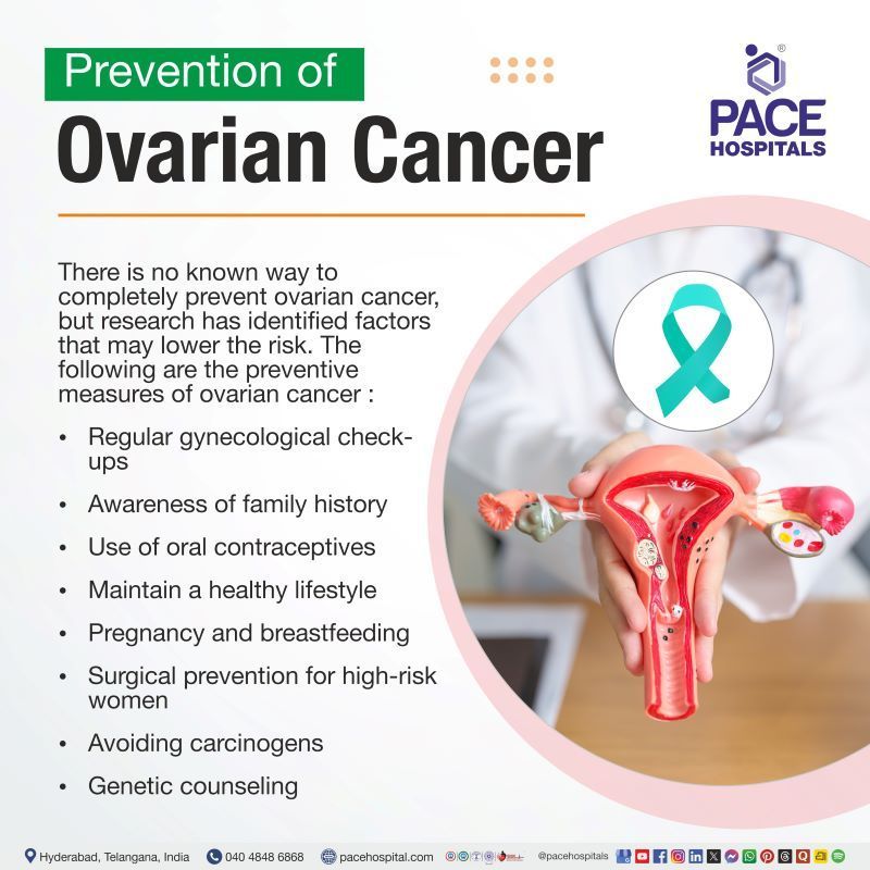 Ovarian Cancer Prevention Ovarian Cancer Prevention | How to prevent ovarian cancer