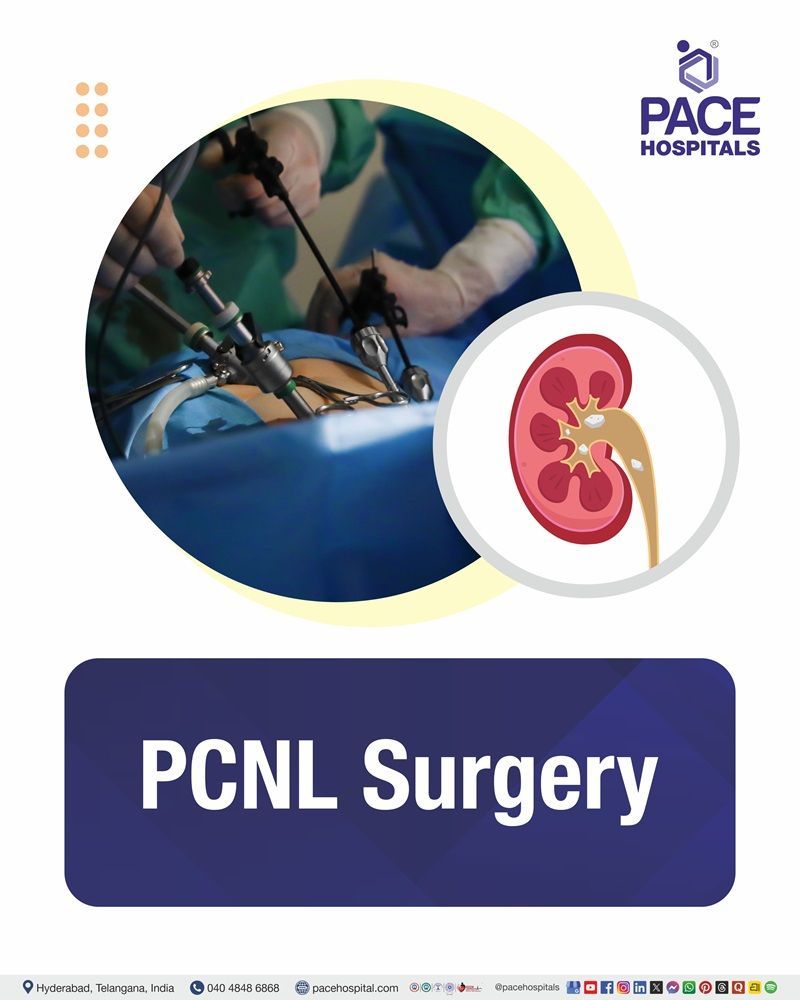 PCNL Surgery Cost in Hyderabad | Affordable Percutaneous Nephrolithotomy in India