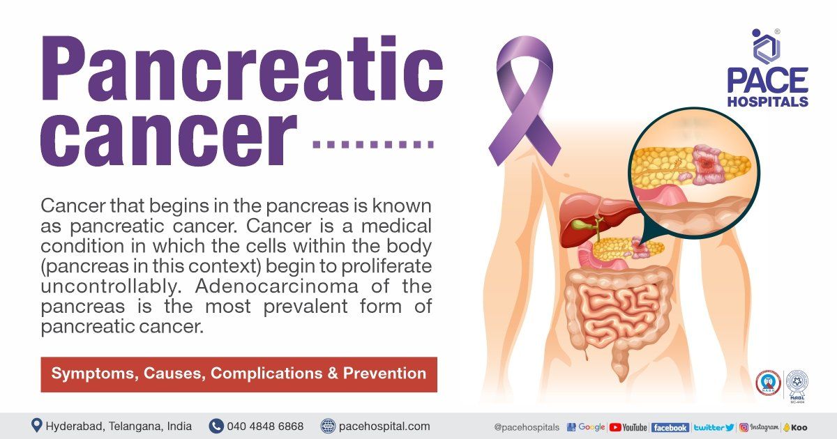 Pancreatic cancer - Symptoms, Causes, Complications & Prevention