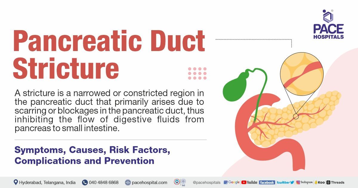 Pancreatic duct stricture: Symptoms, Causes, Risk Factors, Complications, Treatment and Prevention