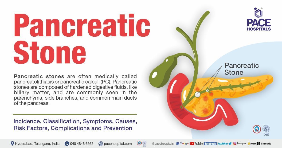 Pancreatic stones - Causes, Symptoms, Incidence, Complications, Risk Factors, Treatment, Prevention