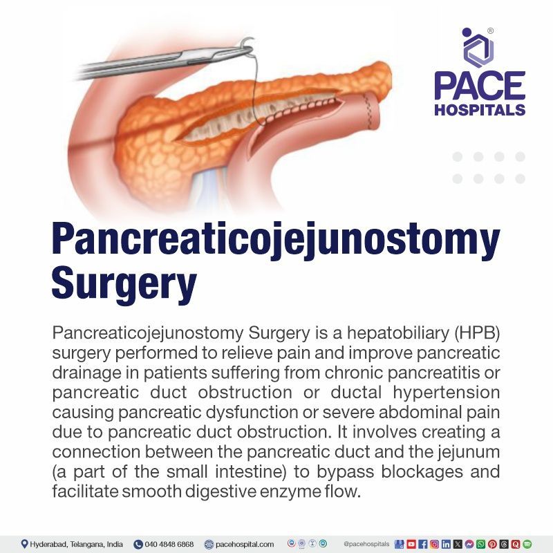 What is Pancreaticojejunostomy Surgery / procedure Pancreaticojejunostomy Surgery meaning | Pancreaticojejunostomy Surgery cost in Hyderabad India