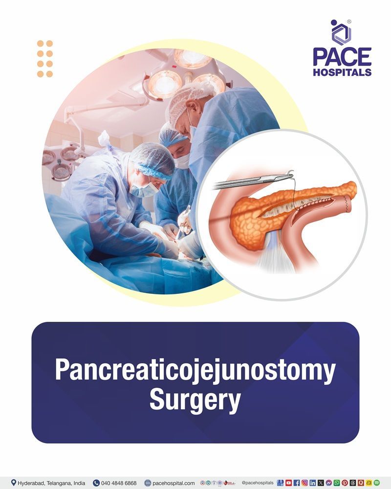 Pancreaticojejunostomy Surgery Cost in Hyderabad | Affordable Pancreaticojejunostomy in India