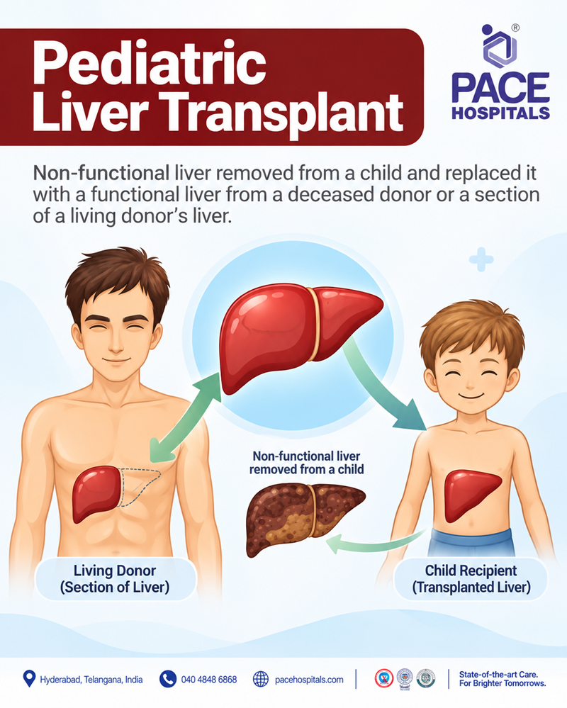 what is pediatric liver transplant | childrens liver transplantation in India | paediatric liver transplant in hyderabad, telangana
