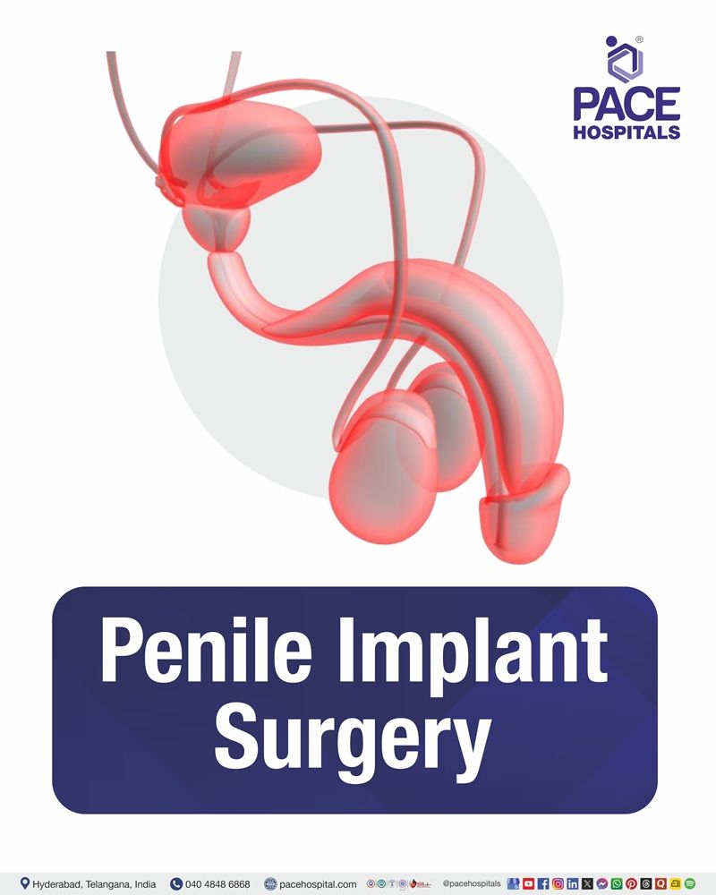 Penile Implant Surgery Cost in Hyderabad | Affordable Penile Implant Surgery in India