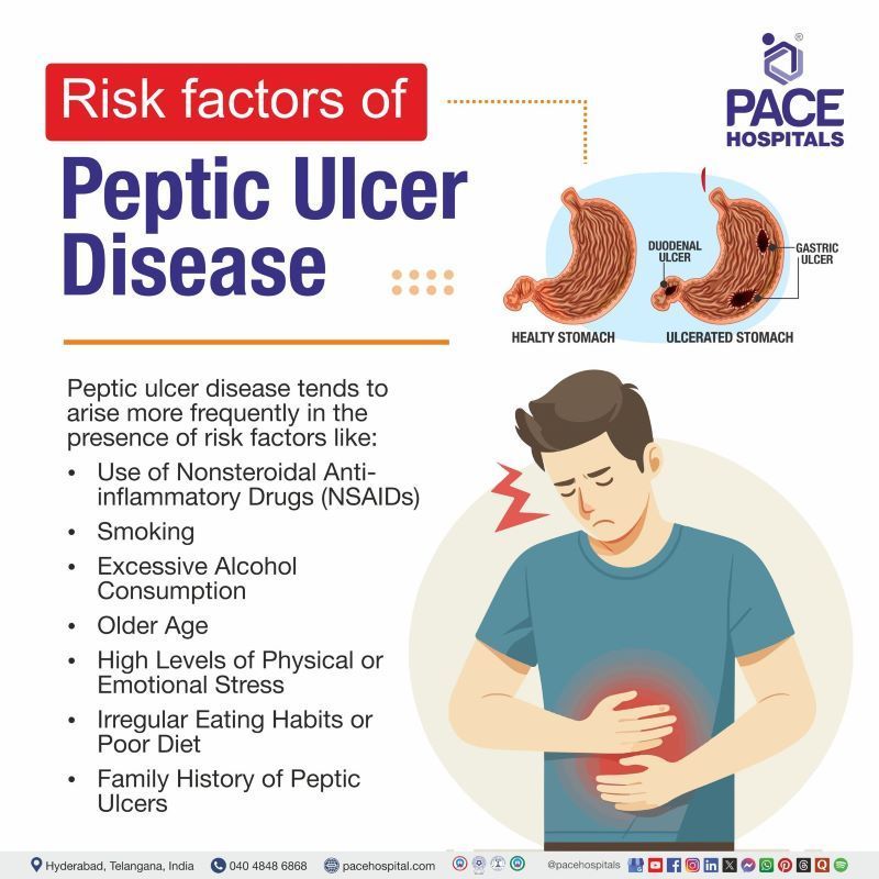 Peptic Ulcer Disease Risk Factors Risk Factors for Peptic Ulcer Disease | Peptic Ulcer Disease Risk Factors