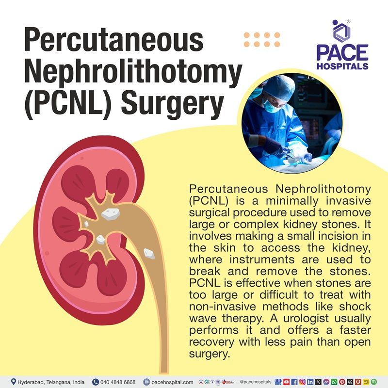 what is endoscopic spine surgery​ | endoscopic spine surgery meaning