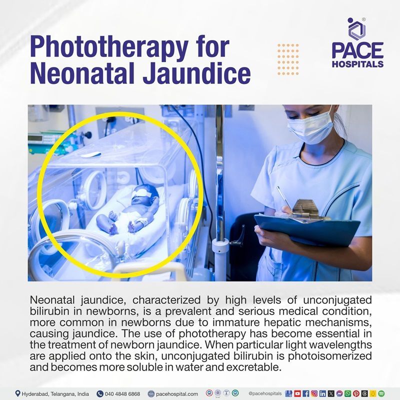 what is phototherapy for neonatal jaundice best phototherapy treatment hospital for jaundice in newborn in Hyderabad | phototherapy treatment near me for newborn | phototherapy treatment for baby