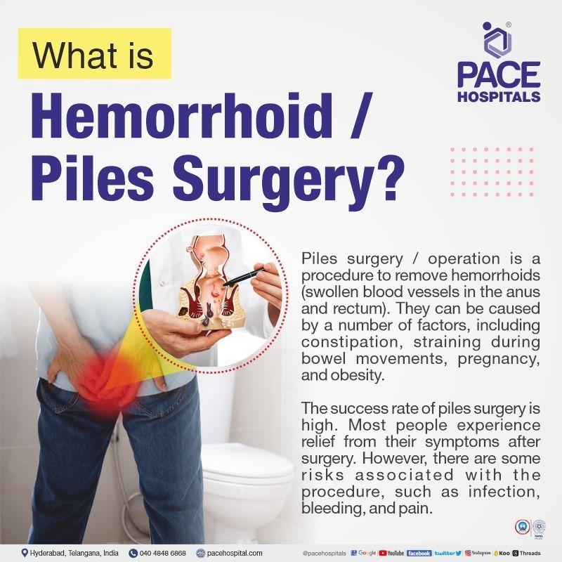 what is Hemorrhoids or Piles Surgery Best Hospital for Piles Surgery in Hyderabad, India | piles laser surgery cost in hyderabad | piles surgery cost in hyderabad