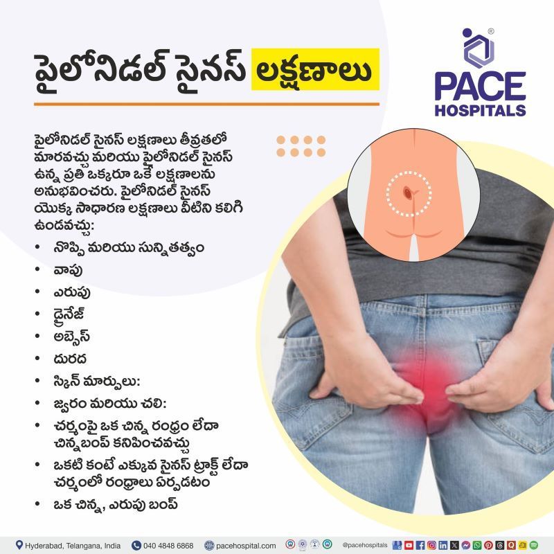 పైలోనిడల్ సైనస్ లక్షణాలు | Pilonidal Sinus Symptoms in Telugu Pilonidal Sinus Symptoms in Telugu | పైలోనిడల్ సైనస్ లక్షణాలు | Symptoms of Pilonidal Sinus in Telugu