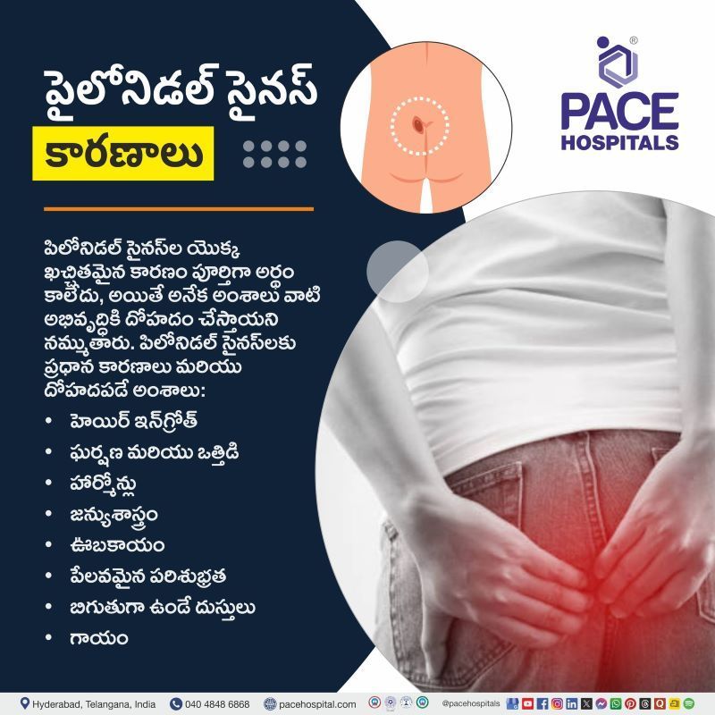 పైలోనిడల్ సైనస్ కారణాలు | Pilonidal Sinus Causes in Telugu Pilonidal Sinus Causes in Telugu | పైలోనిడల్ సైనస్ కారణాలు | Causes of Pilonidal Sinus in Telugu