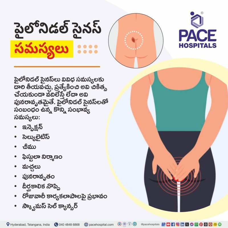 పైలోనిడల్ సైనస్ సమస్యలు | Pilonidal Sinus Complications in Telugu Pilonidal Sinus Complications in Telugu | పైలోనిడల్ సైనస్ సమస్యలు | Complications of Pilonidal Sinus in Telugu