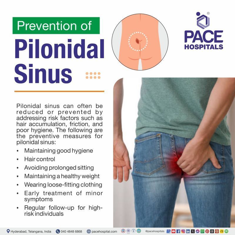 Pilonidal Sinus Prevention pilonidal sinus prevention | pilonidal sinus prevention of recurrence | prevention of pilonidal sinus