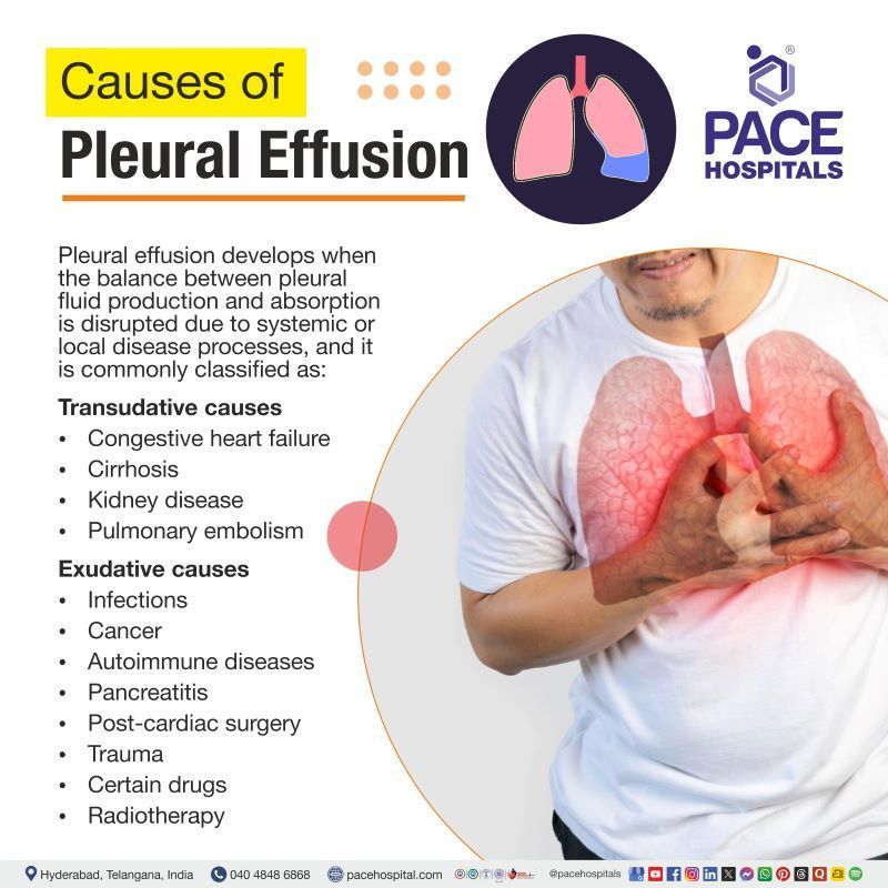 Pleural Effusion Causes Pleural Effusion Causes | Causes of pleural effusion | Bilateral pleural effusion causes