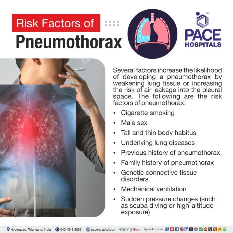 Pneumothorax Risk Factors Pneumothorax Risk Factors | Risk factors for Pneumothorax