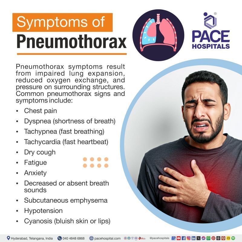 Pneumothorax Symptoms Pneumothorax Symptoms | Pneumothorax signs and symptoms