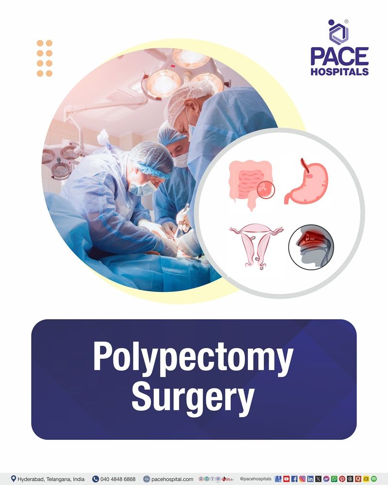 Polyp Removal Surgery Cost in Hyderabad | Affordable Polypectomy in Indi