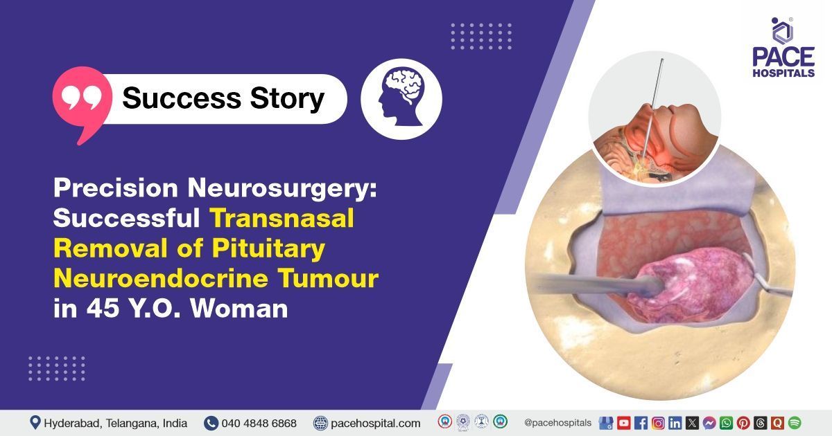 Case study of a 45-year-old woman who underwent pituitary tumor treatment at PACE Hospitals