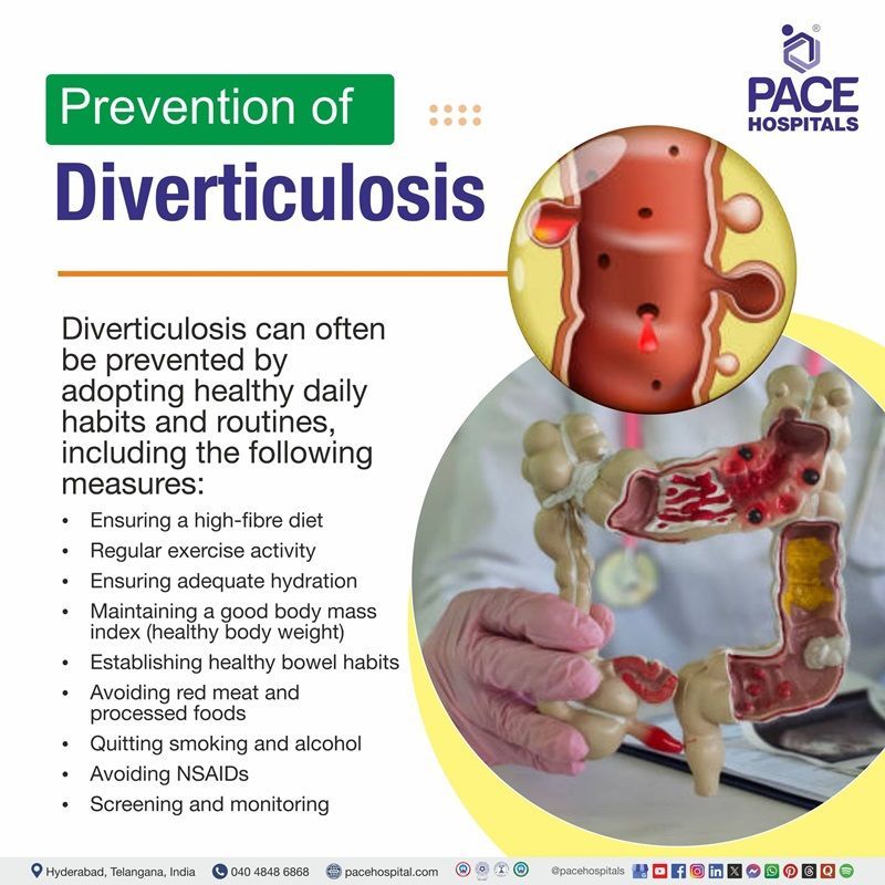 Diverticulosis Preventive measures | Diverticulosis Preventive tips