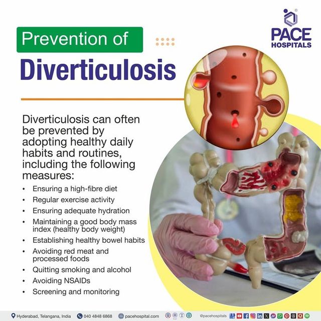 Diverticulosis