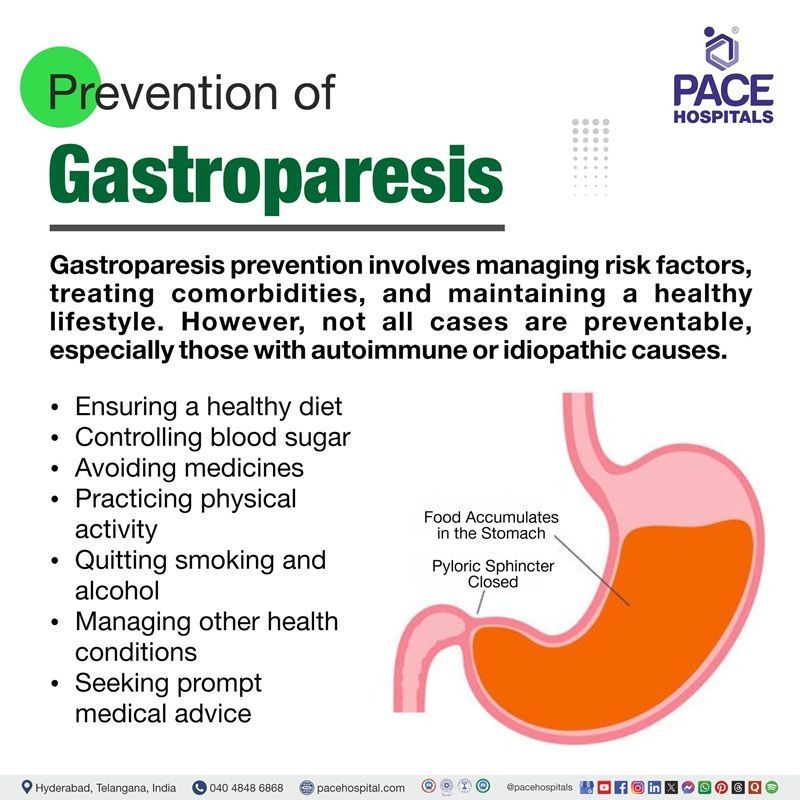 Gastroparesis Prevention Gastroparesis Prevention | Prevention of Gastroparesis