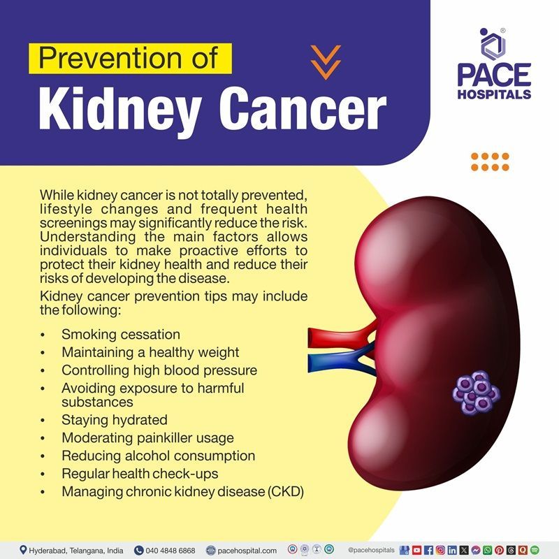 Kidney cancer preventions Kidney cancer preventions | Visual depicting kidney cancer preventive tips