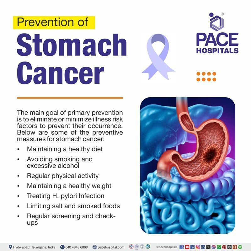 Stomach cancer prevention Stomach cancer preventions | image showing the stomach cancer diagram and stomach cancer prevention measures