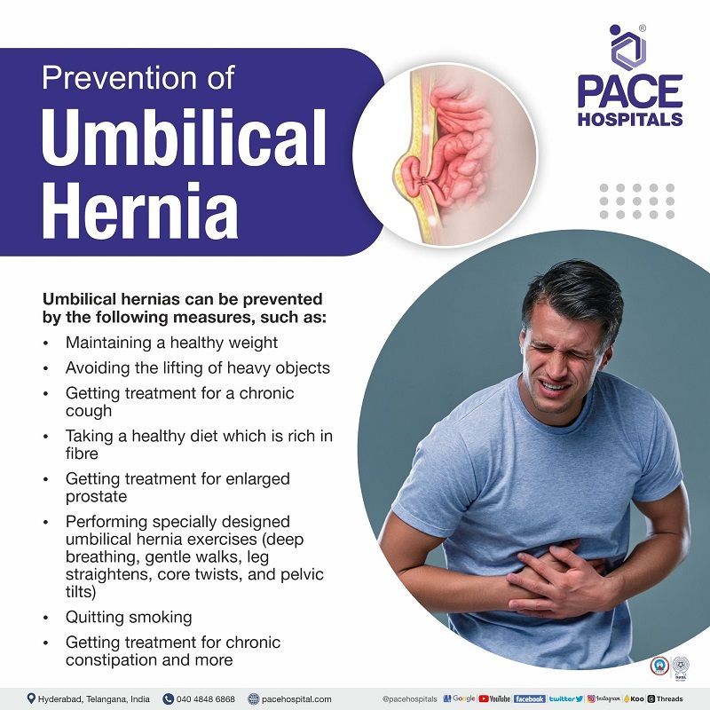 How to prevent Umbilical Hernia umbilical hernia prevention, India | how to avoid umbilical hernia | how to prevent umbilical hernia in newborns | umbilical hernia management | prevention of umbilical hernia